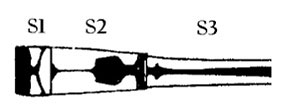 Dorsal abdominal markings, S1-3, Austroallagma sagittiferum.